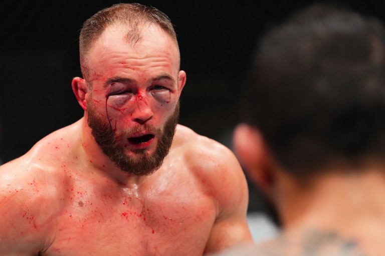 UFC fighter Mateusz Rebecki shows off gruesome facial injury after TKO loss