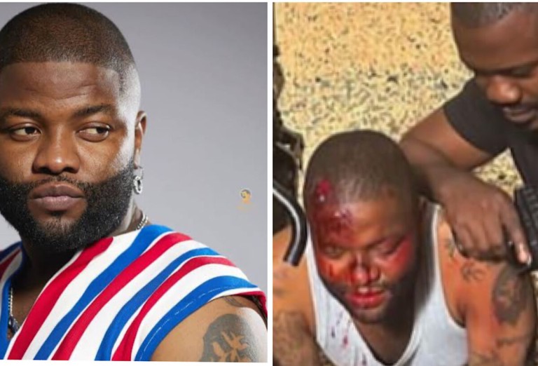 My first ever acting role” – Singer Skales finally shares reason behind bloodied face