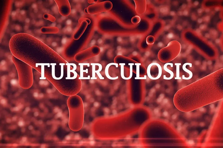 Benue State Government Treats Over 1,900 Tuberculosis Patients in Three Months